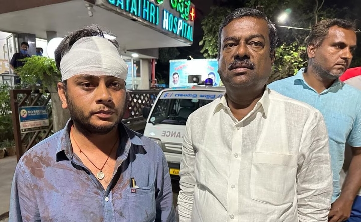 कर्नाटक चुनाव से पहले बेंगलुरु में भिड़े बीजेपी और कांग्रेस कार्यकर्ता, कई लोग जख्मी